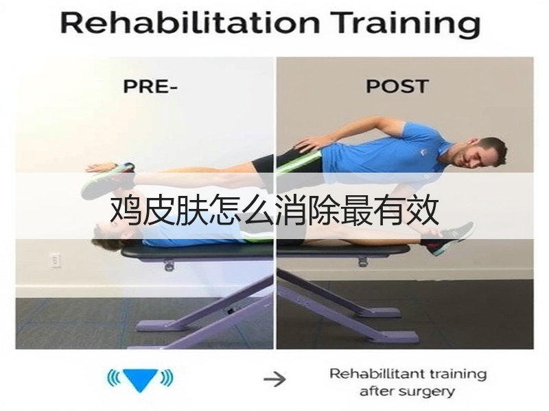鸡皮肤怎么消除最有效