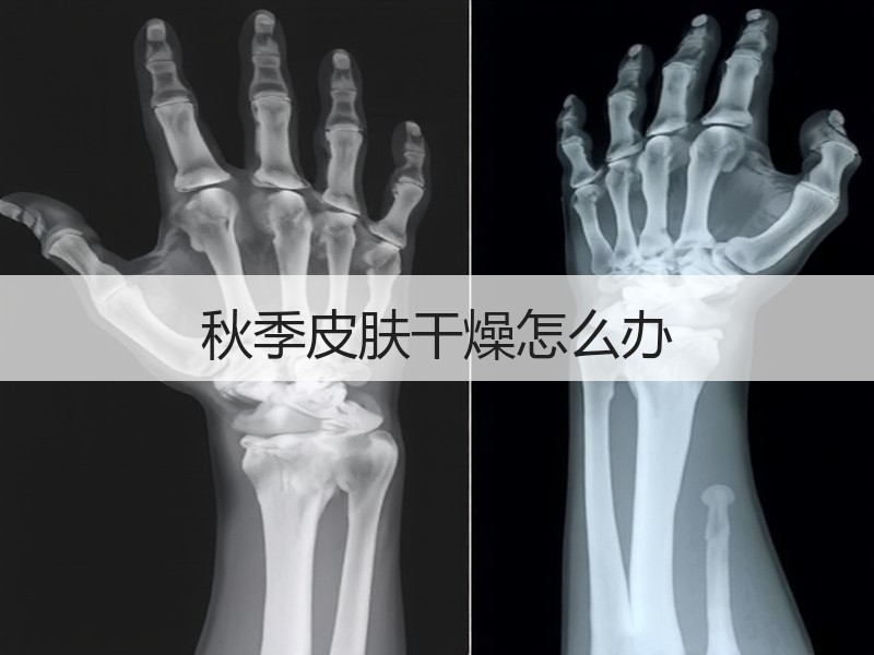 秋季皮肤干燥怎么办