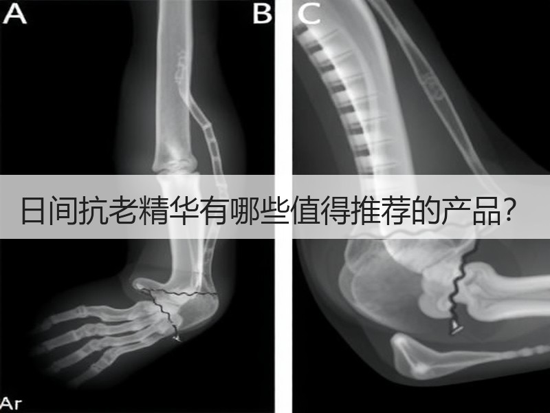 日间抗老精华有哪些值得推荐的产品？