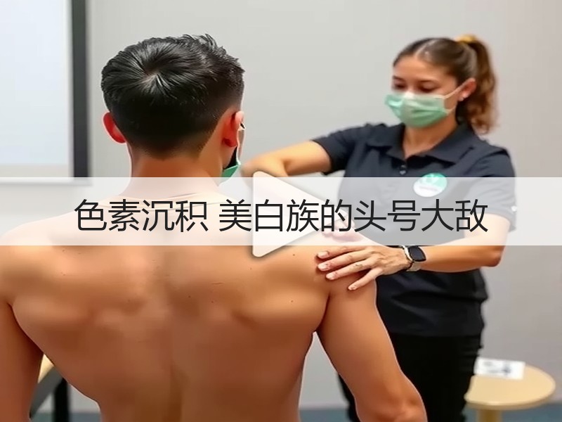 色素沉积 美白族的头号大敌