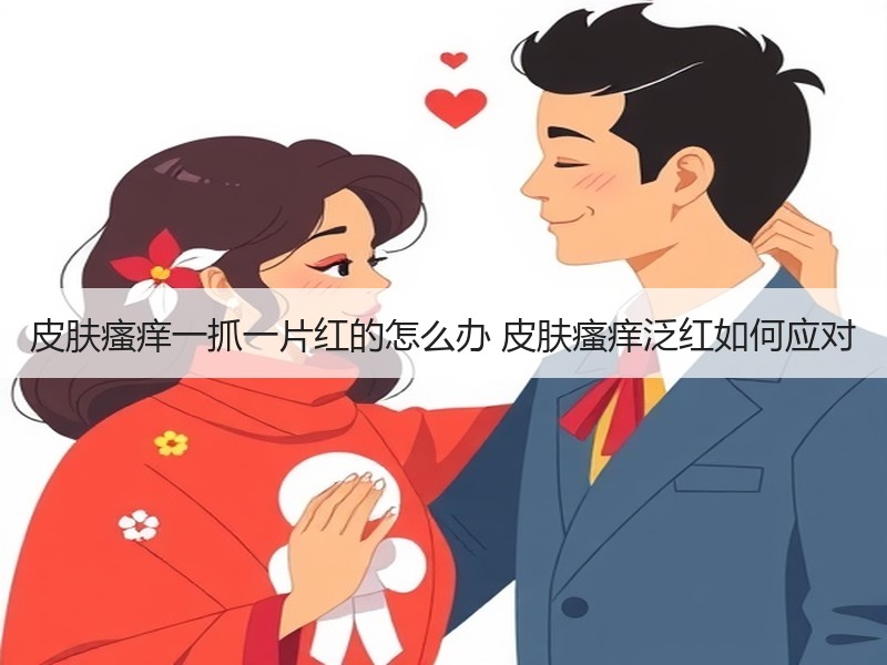 皮肤瘙痒一抓一片红的怎么办 皮肤瘙痒泛红
